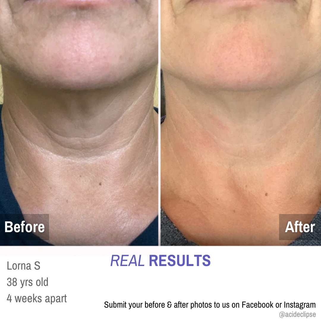 GoPure™ Tighten & Lift Neck Cream